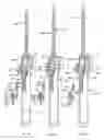 Fig. 40 - Methods and apparatus for endovascularly replacing a heart valve
