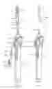 Fig. 41 - Methods and apparatus for endovascularly replacing a heart valve