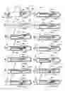 Fig. 49 - Methods and apparatus for endovascularly replacing a heart valve