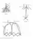 Fig. 55 - Methods and apparatus for endovascularly replacing a heart valve