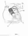 Fig. 02 - Cardiovascular implant, method and device for its production, and its provision for surgery