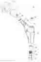 Fig. 01 - Sleeve and method for use with modular orthopaedic implants