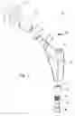 Fig. 02 - Sleeve and method for use with modular orthopaedic implants