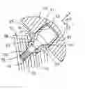 Fig. 01 - Joint prosthesis with infinitely positionable head