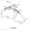 Fig. 01 - Patellar prosthetic arrangement and associated surgical method