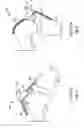 Fig. 02 - Patellar prosthetic arrangement and associated surgical method