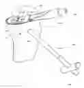 Fig. 01 - Tibial condylar hemiplasty implants, anchor assemblies, and related methods