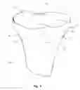 Fig. 02 - Tibial condylar hemiplasty implants, anchor assemblies, and related methods