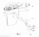 Fig. 06 - Tibial condylar hemiplasty implants, anchor assemblies, and related methods