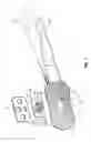 Fig. 08 - Tibial condylar hemiplasty implants, anchor assemblies, and related methods