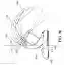 Fig. 09 - High flexion articular insert