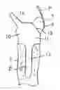 Fig. 01 - Soft tissue attachment system and method