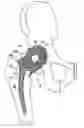 Fig. 01 - One piece snap fit acetabular cup