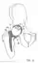Fig. 06 - One piece snap fit acetabular cup