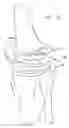 Fig. 35 - One piece snap fit acetabular cup