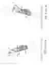 Fig. 02 - Artificial knee joint