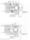 Fig. 08 - Artificial knee joint