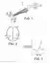 Fig. 02 - System and method for speech generation from brain activity