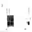 Fig. 07 - Increasing salt tolerance in plants by overexpression of vacuolar NA/H transporters