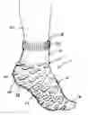 Fig. 01 - Slip-resistant stocking