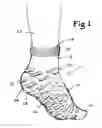 Fig. 02 - Slip-resistant stocking