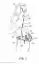Fig. 03 - Anatomically fitted respiratory component belt