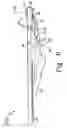 Fig. 07 - Patient support with variable length actuator and release mechanism for lowering a sectional support surface