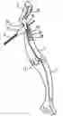 Fig. 01 - Inter-dental brush structure