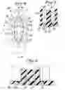 Fig. 03 - Toothbrush