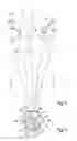 Fig. 04 - Vase and foot therefor