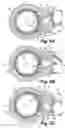 Fig. 05 - Reversible ratcheting tool with improved control member