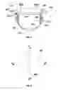 Fig. 05 - Helical perch bird feeder
