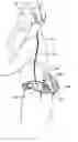 Fig. 01 - Respiratory component mounting assembly