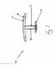 Fig. 02 - Transtracheal oxygen stent