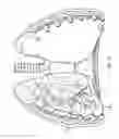 Fig. 02 - Bronchial flow control devices and methods of use