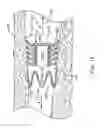 Fig. 12 - Bronchial flow control devices and methods of use