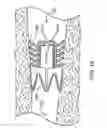 Fig. 18 - Bronchial flow control devices and methods of use