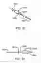 Fig. 31 - Bronchial flow control devices and methods of use
