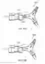 Fig. 49 - Bronchial flow control devices and methods of use