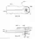 Fig. 52 - Bronchial flow control devices and methods of use