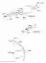 Fig. 56 - Bronchial flow control devices and methods of use