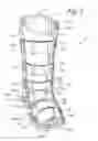 Fig. 03 - Orthopedic walker having a soft boot with a deformable insert
