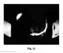 Fig. 12 - Composition, Method and Device for Blood Supply Fluctuation Therapy