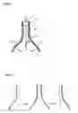 Fig. 02 - Method of manufacturing ceramic bottle for plastic cork