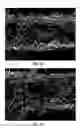 Fig. 35 - Splittable cloth like tissue webs