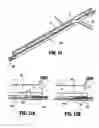 Fig. 16 - Surgical stapling apparatus having a wound closure material applicator assembly