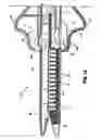 Fig. 17 - Surgical stapling apparatus having a wound closure material applicator assembly