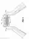 Fig. 04 - Spoon-shaped grating implement