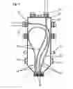 Fig. 07 - Device for supporting or routing lines in passages