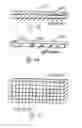 Fig. 16 - Apparatus and method for automatically adjusting the path of a medical camera